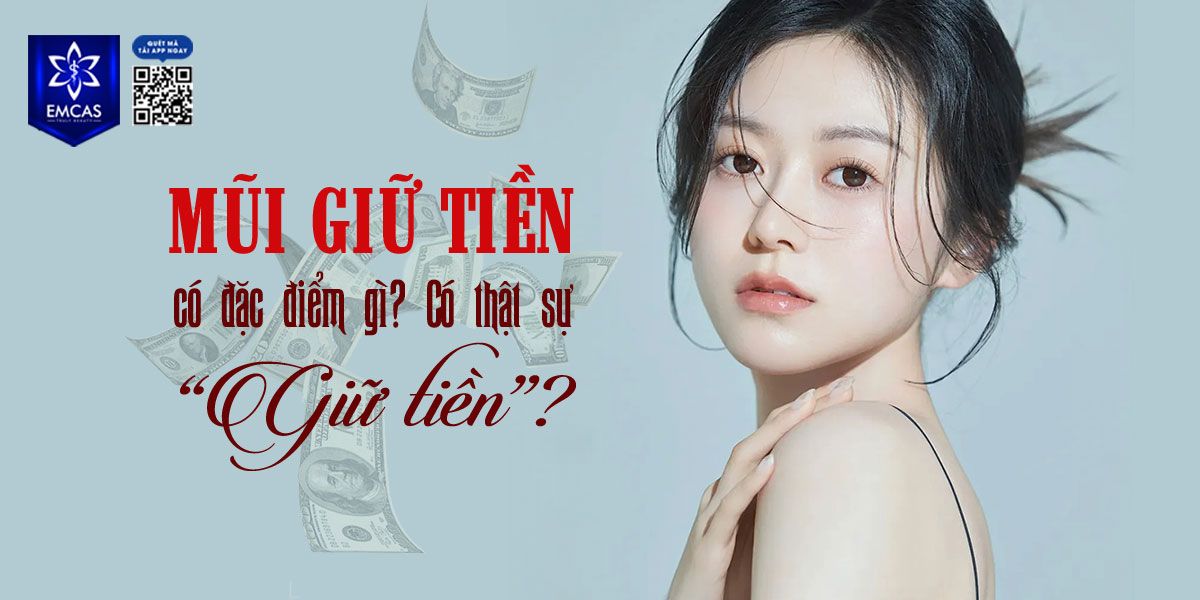 MŨI GIỮ TIỀN CÓ ĐẶC ĐIỂM GÌ?