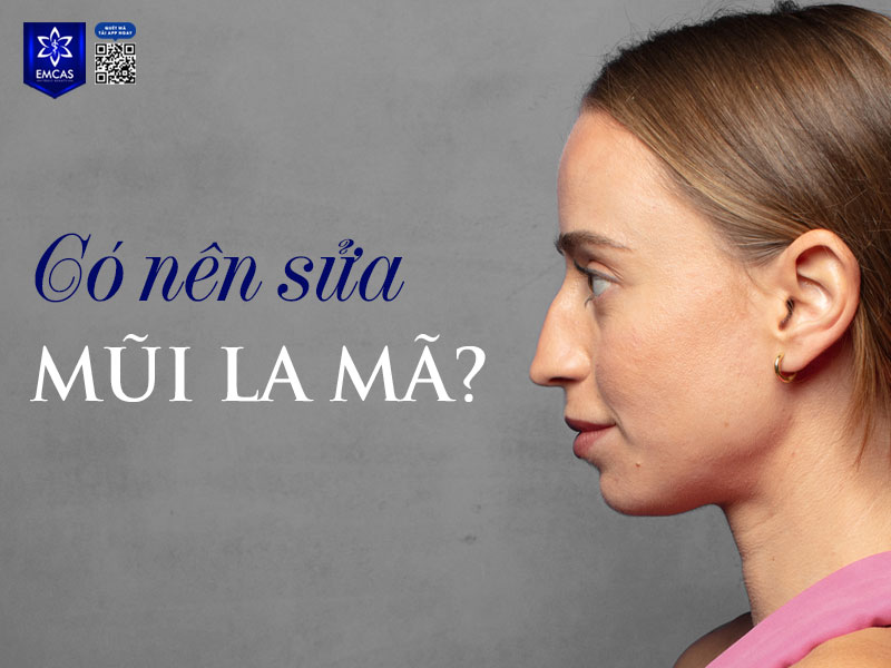 Việc có nên sửa mũi La Mã hay không phụ thuộc vào hai yếu tố chính: sự hài hòa của dáng mũi với tổng thể gương mặt và mong muốn chủ quan của mỗi người.