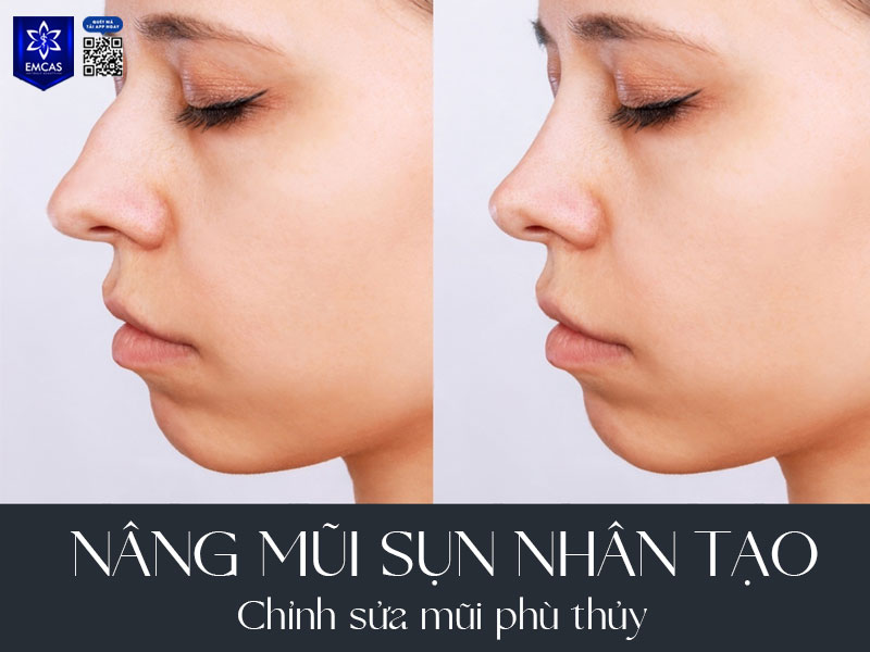 Việc sửa mũi không chỉ mang lại lợi ích về mặt ngoại hình mà còn góp phần tăng sự tự tin, cải thiện tinh thần và mở ra nhiều cơ hội tốt đẹp trong công việc, cuộc sống.