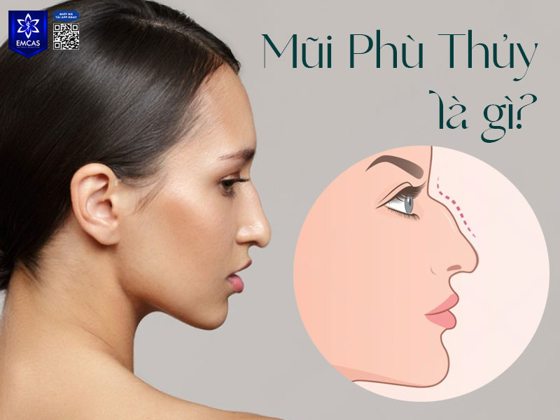 Mũi phù thủy có phần sống mũi gồ cao, chóp mũi nhọn và thường hơi quặp xuống