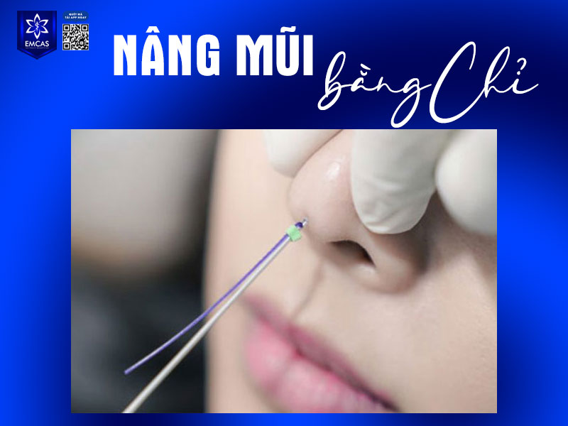 Quy trình thực hiện nâng mũi bằng chỉ