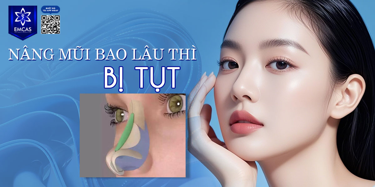 NÂNG MŨI BAO LÂU THÌ BỊ TỤT?