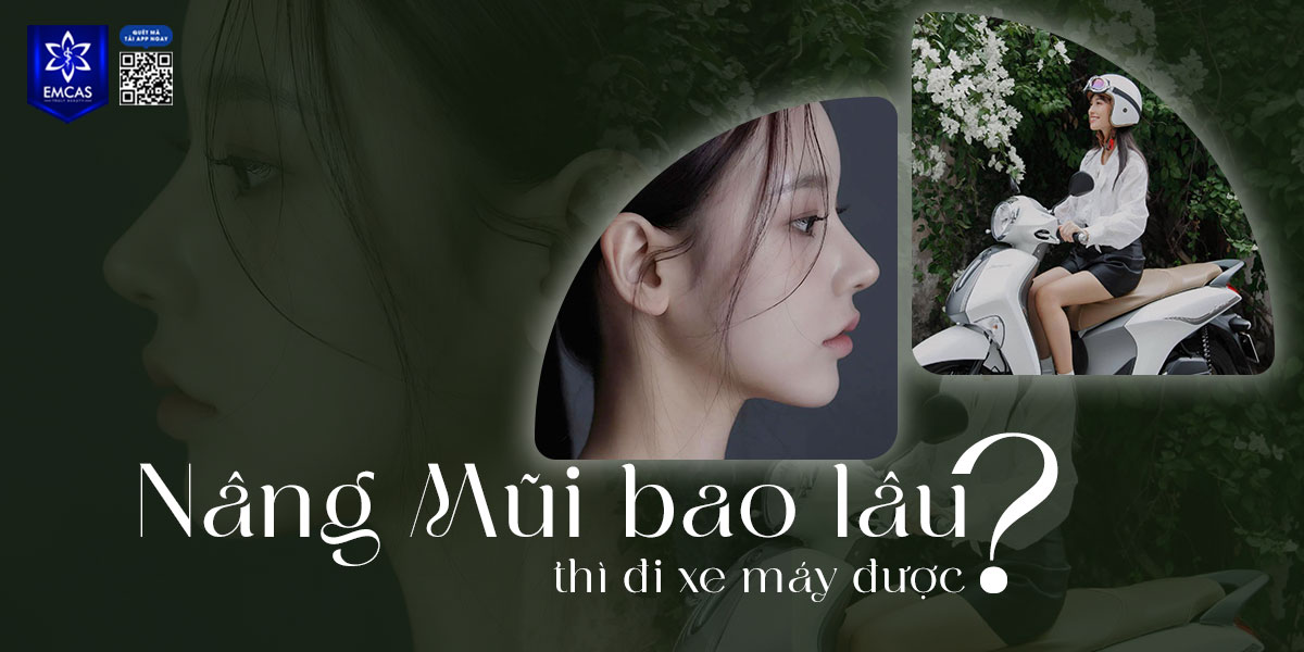 NÂNG MŨI BAO LÂU THÌ ĐI XE MÁY ĐƯỢC?