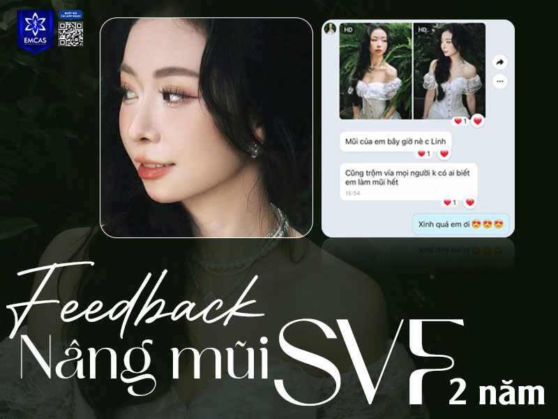 Việc tuân thủ hướng dẫn chăm sóc tại nhà đóng vai trò quan trọng giúp mũi vào form đẹp, bền dáng và tự nhiên lâu dài.