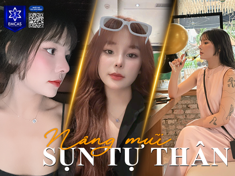 Chế độ chăm sóc sau nâng mũi cũng là một vấn đề mà bạn cần quan tâm vì đây là yếu tố quan trọng ảnh hưởng đến tốc độ hồi phục và hiệu quả thẩm mỹ lâu dài.