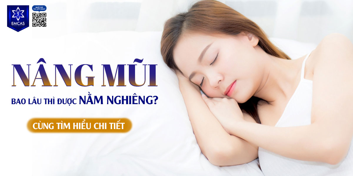 NÂNG MŨI BAO LÂU THÌ ĐƯỢC NẰM NGHIÊNG?