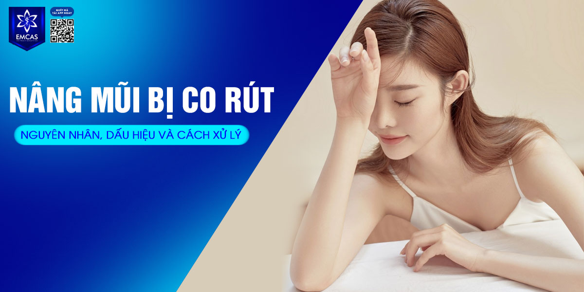 NÂNG MŨI BỊ CO RÚT