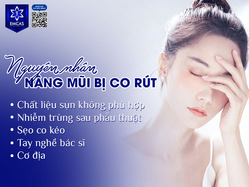 Nâng mũi bị co rút là tình trạng đầu mũi bị kéo ngắn lại, sống mũi tụt xuống hoặc cong vênh so với dáng mũi ban đầu.