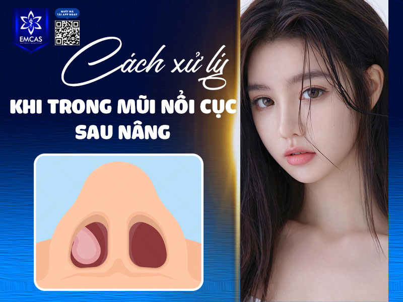 Nếu có bất kỳ vấn đề bất thường nào, hãy đến thăm khám tại bệnh viện thẩm mỹ uy tín, không nên tự ý nặn, chọc hoặc dùng thuốc không rõ nguồn gốc tại nhà.