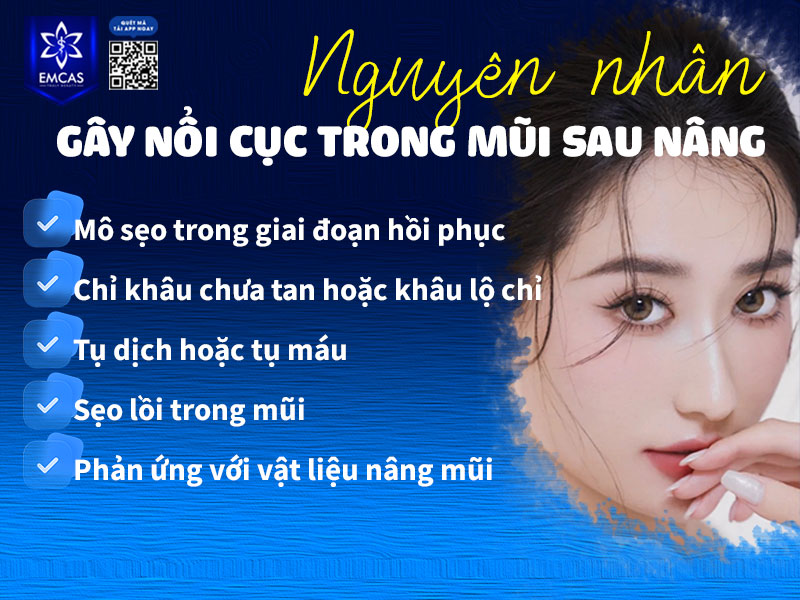 Hiện tượng nâng mũi bị nổi cục trong lỗ mũi có thể xuất phát từ nhiều nguyên nhân khác nhau
