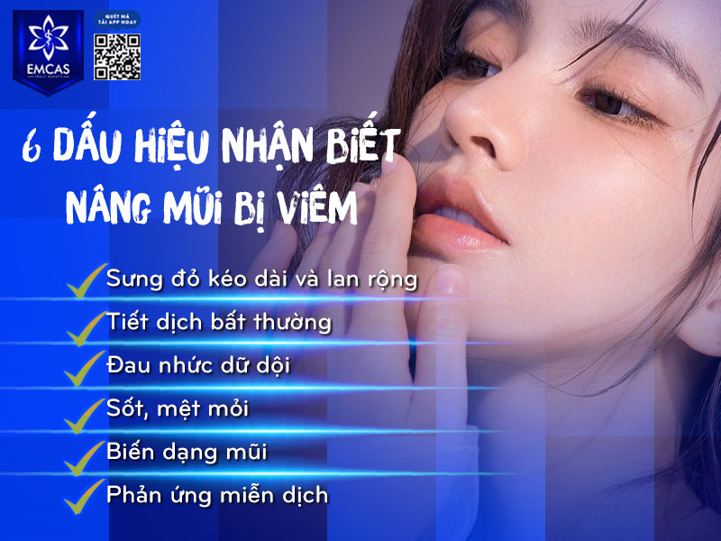 Nâng mũi bị viêm là khi các triệu chứng dưới đau, nhức, sốt,... xuất hiện kéo dài hoặc trở nên nghiêm trọng.