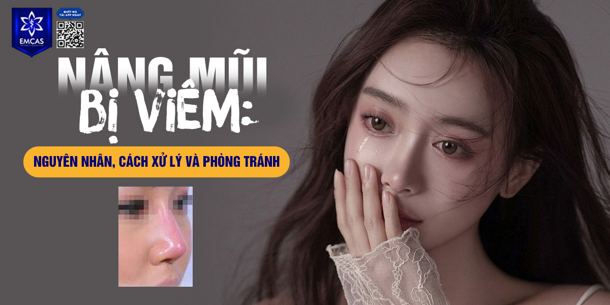 NÂNG MŨI BỊ VIÊM: NGUYÊN NHÂN VÀ CÁCH PHÒNG TRÁNH
