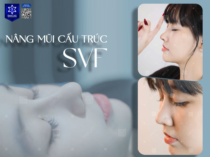 Nâng mũi cấu trúc là phương pháp phẫu thuật tái cấu trúc toàn bộ khung mũi: từ sống, trụ đến đầu mũi