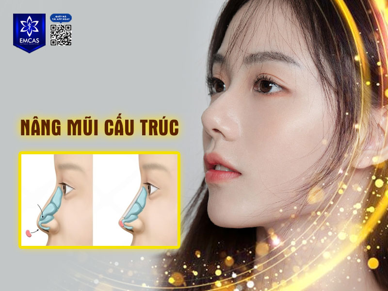 Nâng mũi cấu trúc có sự can thiệp sâu vào phần cấu trúc, hình dáng của mũi