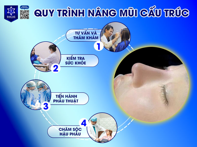 Tại Bệnh Viện Thẩm Mỹ EMCAS, quy trình nâng mũi cấu trúc sẽ trải qua các 4 bước chuẩn y khoa