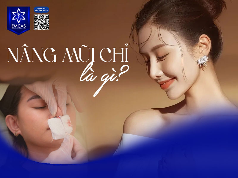 Nâng mũi chỉ là một phương pháp thẩm mỹ không phẫu thuật, sử dụng các sợi chỉ sinh học chuyên dụng để đưa vào vùng sống mũi.