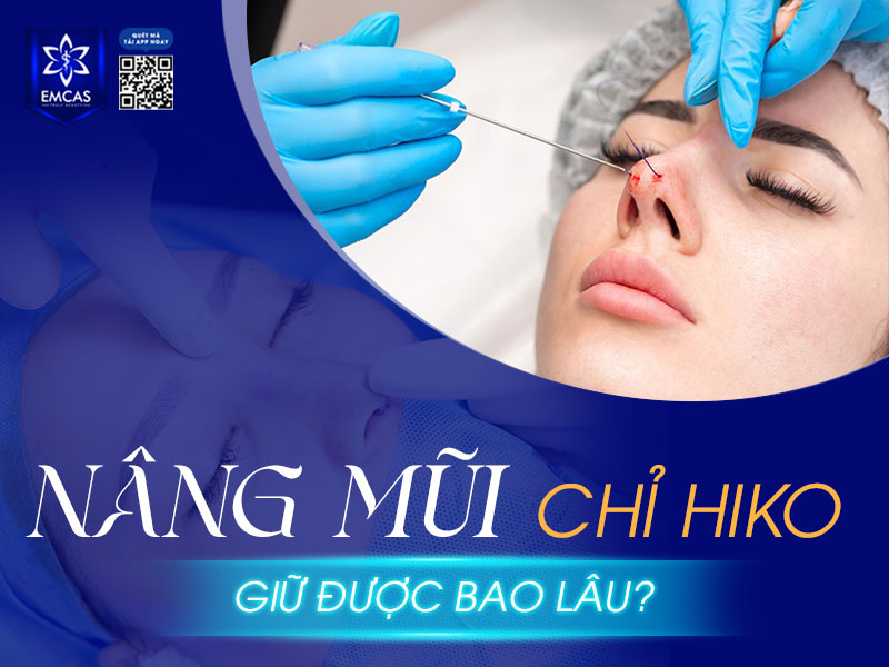 Kết quả của nâng mũi chỉ Hiko có thể duy trì trung bình 12–18 tháng.