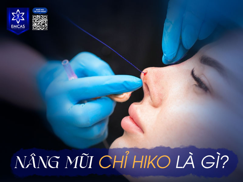 Nâng mũi chỉ Hiko là phương pháp thẩm mỹ không phẫu thuật, sử dụng chỉ sinh học cấy vào dưới da để nâng cao sống mũi, cải thiện dáng mũi tự nhiên và thanh thoát hơn.