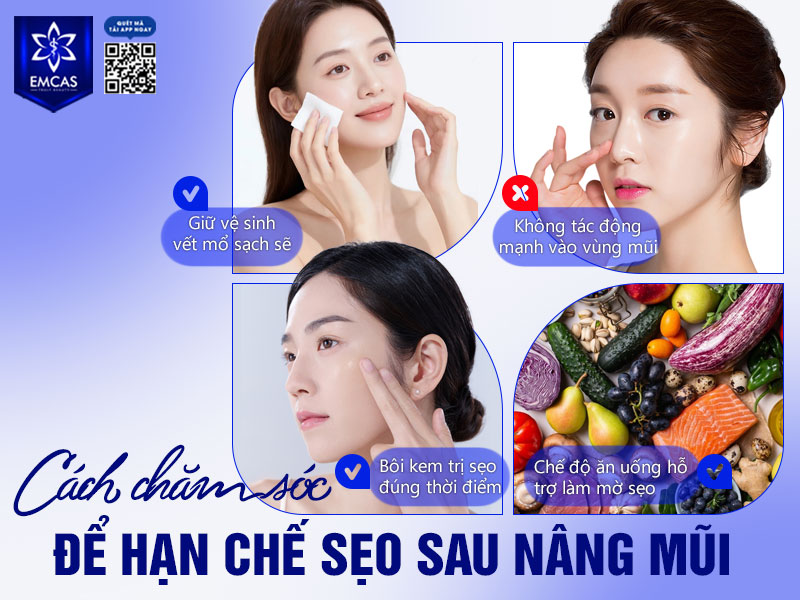 Việc chăm sóc đúng cách sẽ giúp vết thương nhanh lành, hạn chế hình thành sẹo và mang lại dáng mũi tự nhiên, hài hòa.
