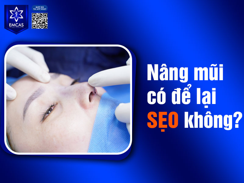 Nâng mũi vẫn có thể để lại sẹo, nhưng mức độ và tính chất của sẹo sẽ phụ thuộc vào nhiều yếu tố