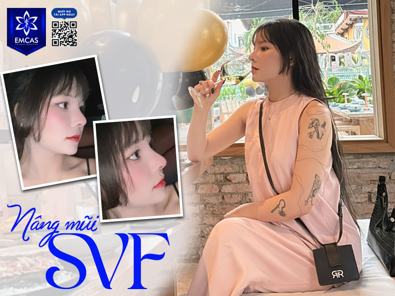 Tại Bệnh Viện Thẩm Mỹ EMCAS, quá trình nâng mũi được thực hiện bởi đội ngũ bác sĩ có chuyên môn sâu và kỹ thuật tốt giúp hạn chế tối đa tình trạng sẹo lồi, sẹo xấu.