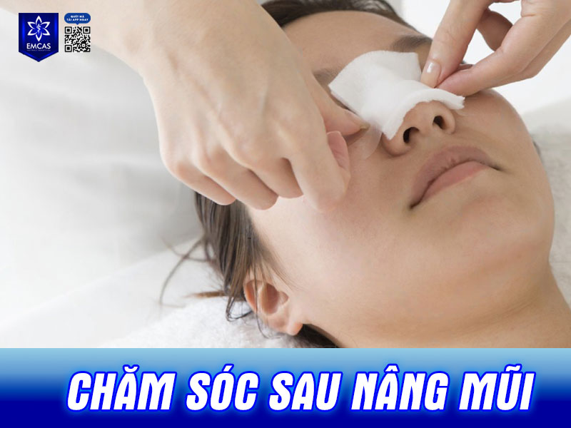 Bên cạnh chế độ ăn uống cũng như vấn đề “nâng mũi có được ăn măng không” thì quá trình chăm sóc tại nhà cũng quyết định phần lớn đến việc dáng mũi có lên form đẹp