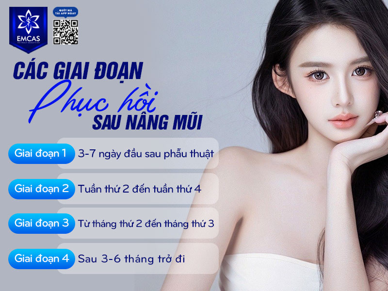 Thời gian hồi phục sau nâng mũi được chia thành 4 giai đoạn khác nhau.