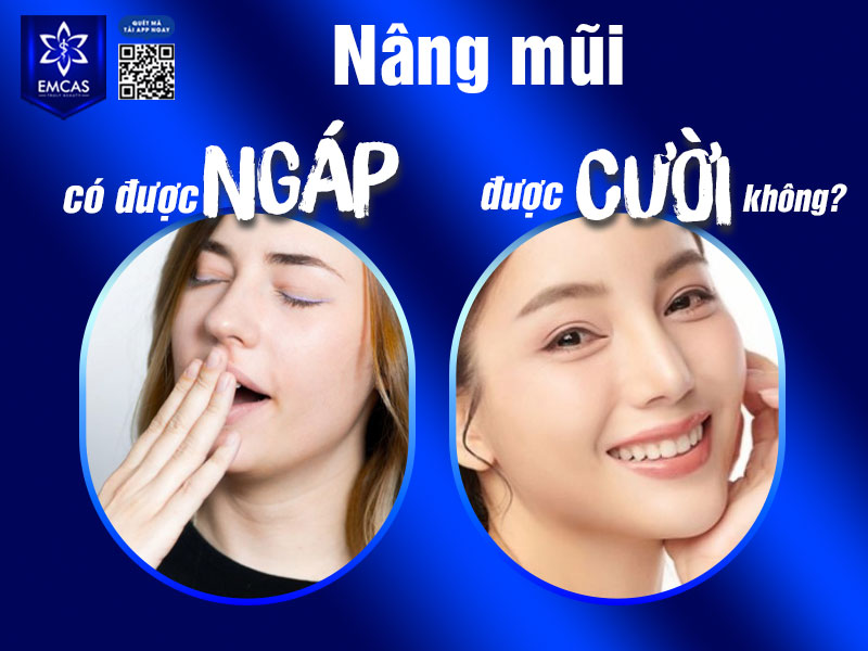Nâng mũi có được ngáp, được cười không? Câu trả lời là hoàn toàn có thể, nhưng cần kiểm soát mức độ và tần suất trong 2–4 tuần đầu để tránh ảnh hưởng đến vết mổ.