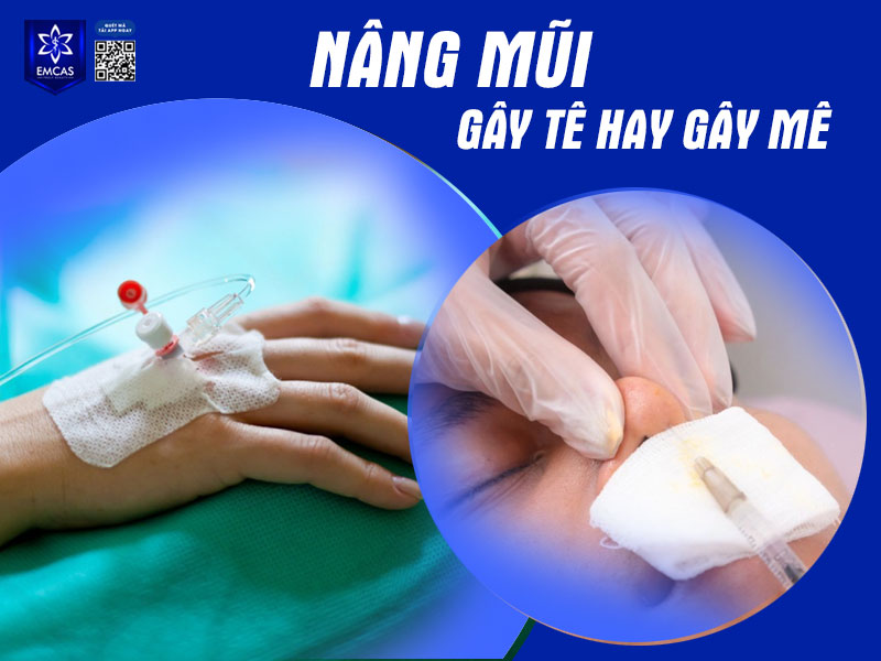 Nâng mũi gây tê hay mê còn phụ thuộc vào dịch vụ nâng mũi mà bạn thực hiện cũng như tình trạng sức khỏe của bạn