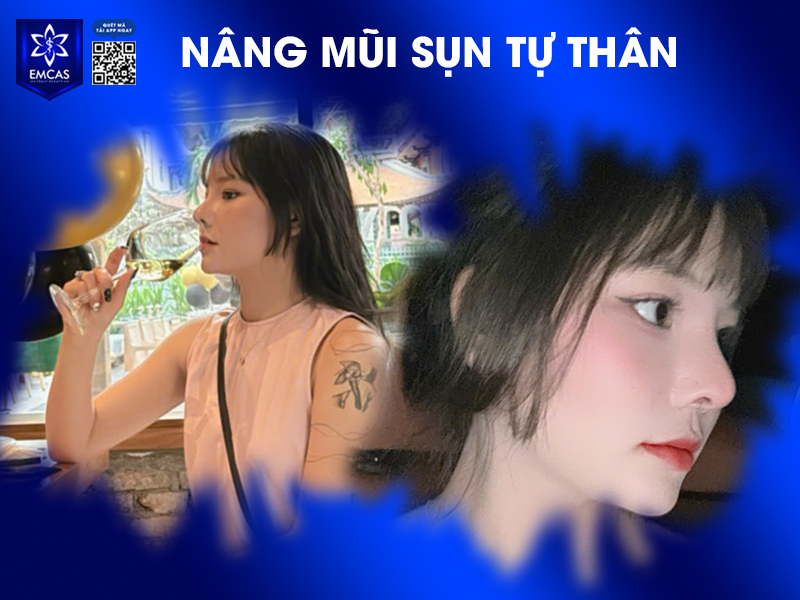 Bệnh Viện Thẩm Mỹ EMCAS là một địa chỉ nâng mũi an toàn, uy tín, được khách hàng tin tưởng