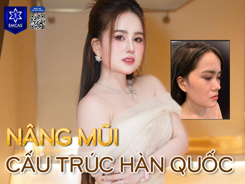 Tại TP.HCM, Bệnh Viện Thẩm Mỹ EMCAS là địa chỉ được nhiều khách hàng tin tưởng