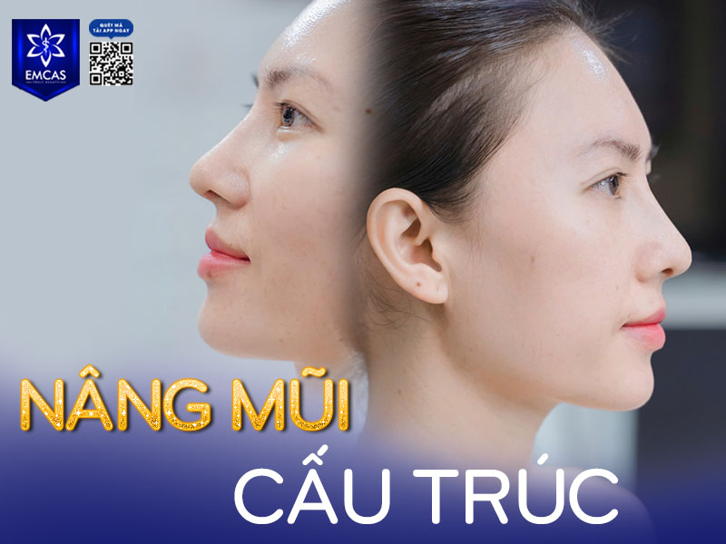 Nâng mũi cấu trúc 4D Hàn Quốc là phương pháp thẩm mỹ tiên tiến giúp tái cấu trúc toàn bộ dáng mũi từ sống, đầu mũi đến trụ mũi, mang lại sự cân đối và tự nhiên tuyệt đối.