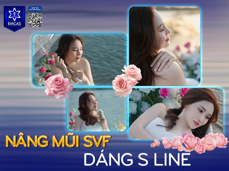 Nâng mũi S line là phương pháp thẩm mỹ tạo hình mũi với đường cong chữ S mềm mại, thanh thoát, phù hợp với đặc điểm gương mặt Á Đông.