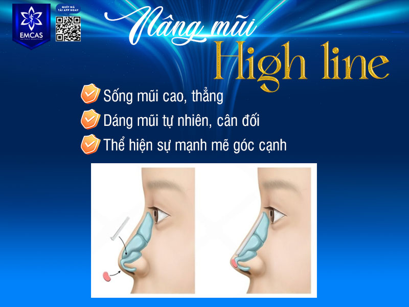 Nâng mũi High Line là phương pháp thẩm mỹ mũi tạo dáng sống mũi cao, thẳng và sắc nét giúp gương mặt trở nên cân đối, sang trọng và hiện đại hơn.