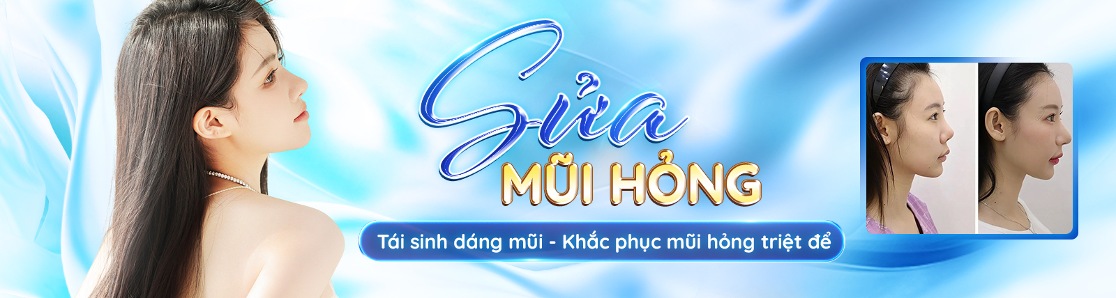 Banner Service Detail