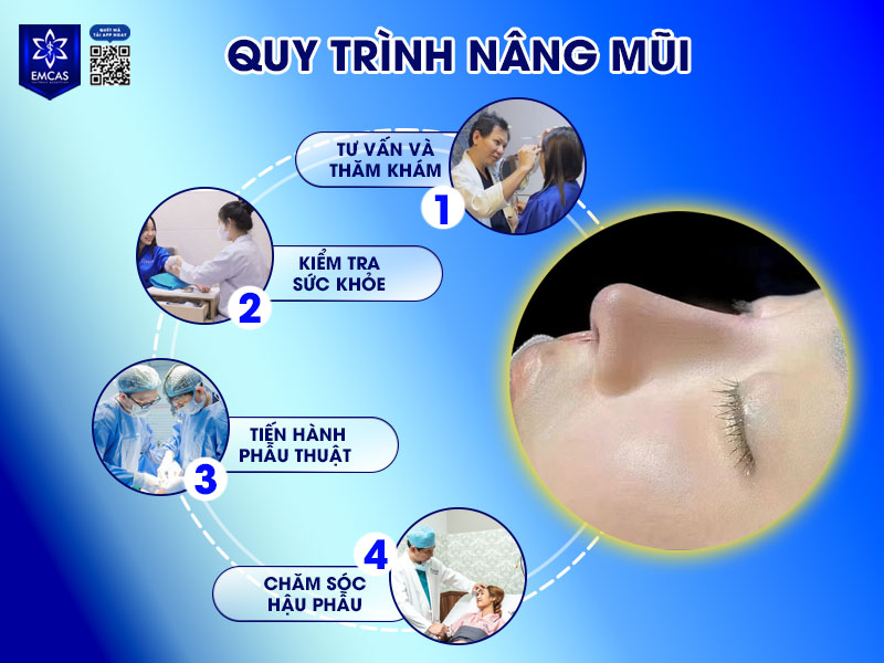 Để đảm bảo an toàn – hiệu quả – ít biến chứng, quy trình nâng mũi tại các bệnh viện thẩm mỹ đạt chuẩn như EMCAS luôn được xây dựng theo lộ trình rõ ràng