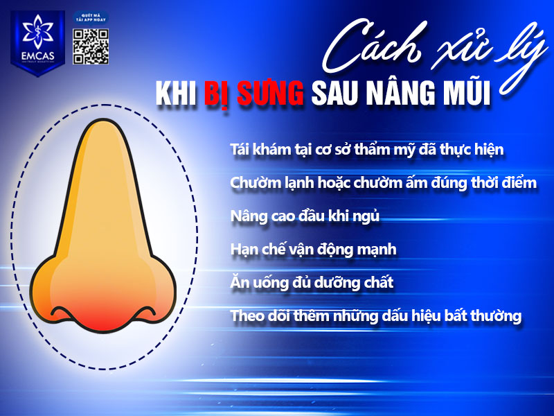 Khi nhận thấy nâng mũi sau 1 tháng bị sưng hoặc xuất hiện tình trạng sưng bất thường, bạn nên xử lý theo hướng phù hợp