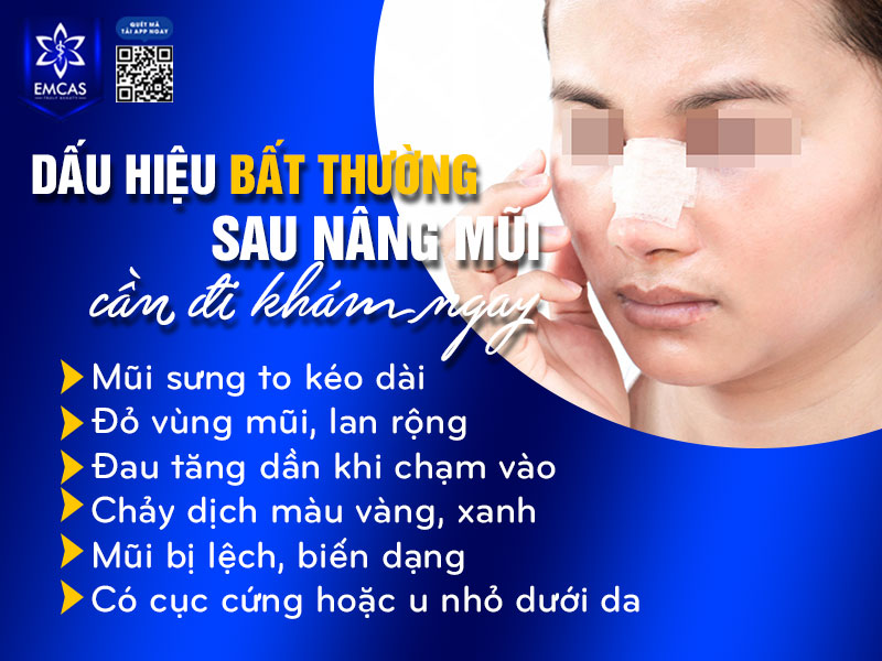 Nếu bạn gặp phải tình trạng nâng mũi sau 1 tháng bị sưng hoặc các dấu hiệu bất thường, hãy đến cơ sở y tế để thăm khám, kiểm tra ngay