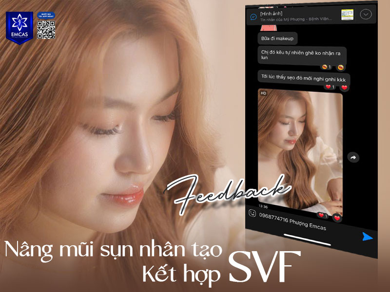 Sụn nhân tạo có chi phí hợp lý phù hợp với khả năng chi tiêu của nhiều người