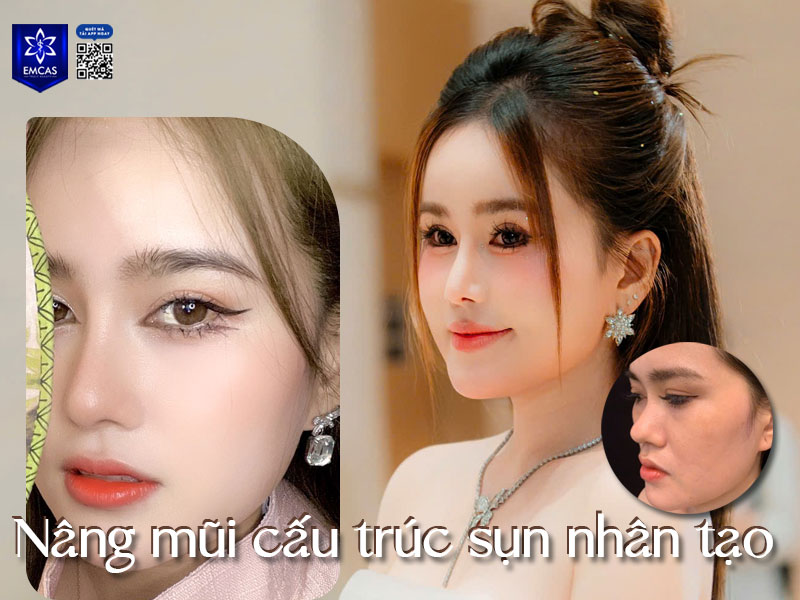 Bệnh Viện Thẩm Mỹ EMCAS có đội ngũ y bác sĩ chuyên môn sâu, giàu kinh nghiệm và hệ thống trang thiết bị hiện đại