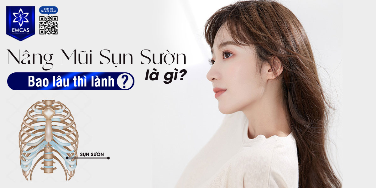 NÂNG MŨI SỤN SƯỜN LÀ GÌ? SỤN SƯỜN NÂNG MŨI BAO LÂU THÌ LÀNH?