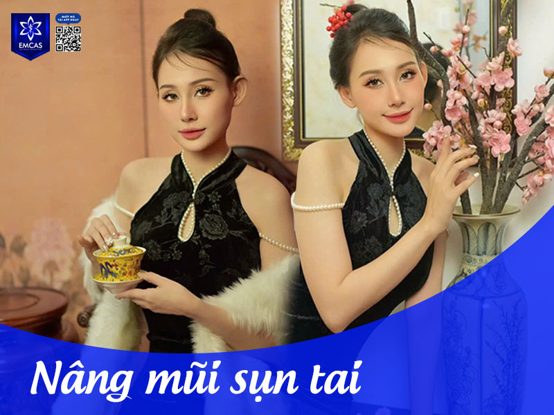 Sụn tai được lấy thông qua đường rạch nhỏ ở mặt sau vành tai không gây ảnh hưởng đến thẩm mỹ hay chức năng của tai