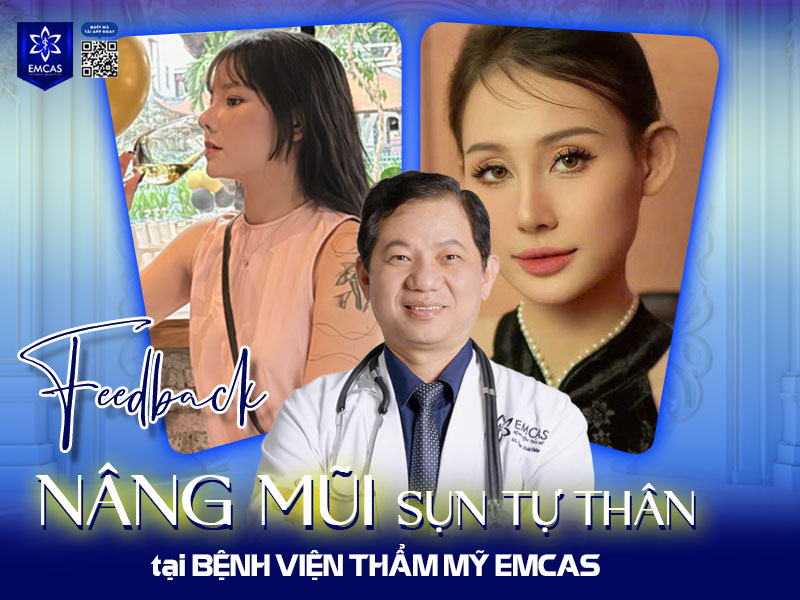 Bệnh Viện Thẩm Mỹ EMCAS - một trong những cơ sở uy tín được nhiều người tin tưởng lựa chọn