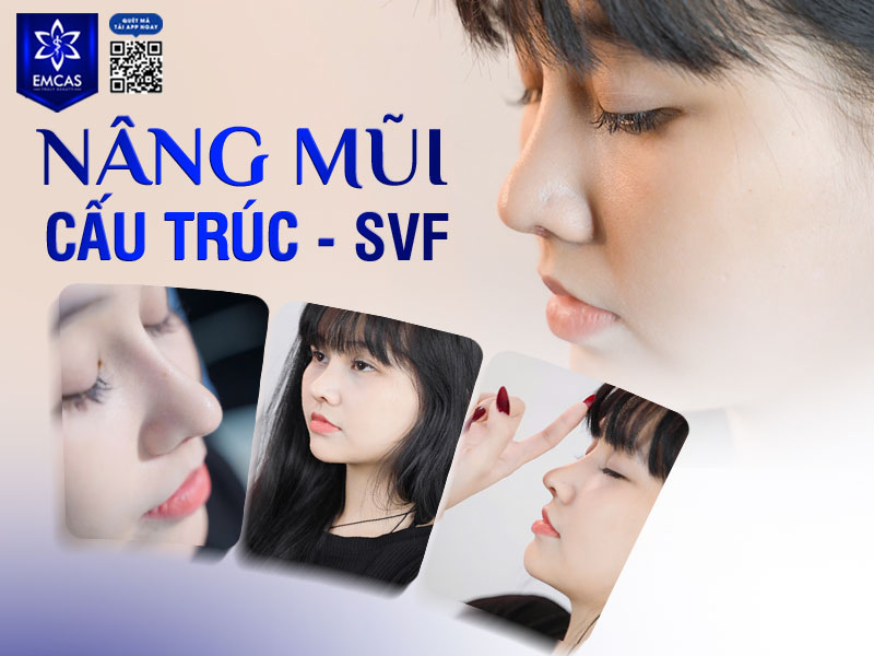 Tại Bệnh Viện Thẩm Mỹ EMCAS, chương trình nâng mũi trả góp được thực hiện thông qua ngân hàng HDBank.