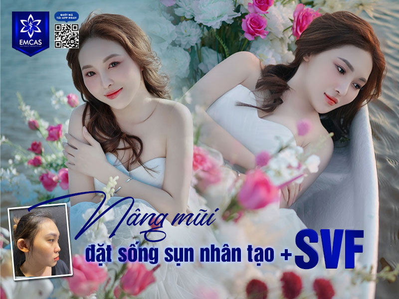 Người có sống mũi thấp, tẹt khiến khuôn mặt thiếu điểm nhấn, trông kém hài hòa là đối tượng phù hợp với phương pháp nâng sống mũi.