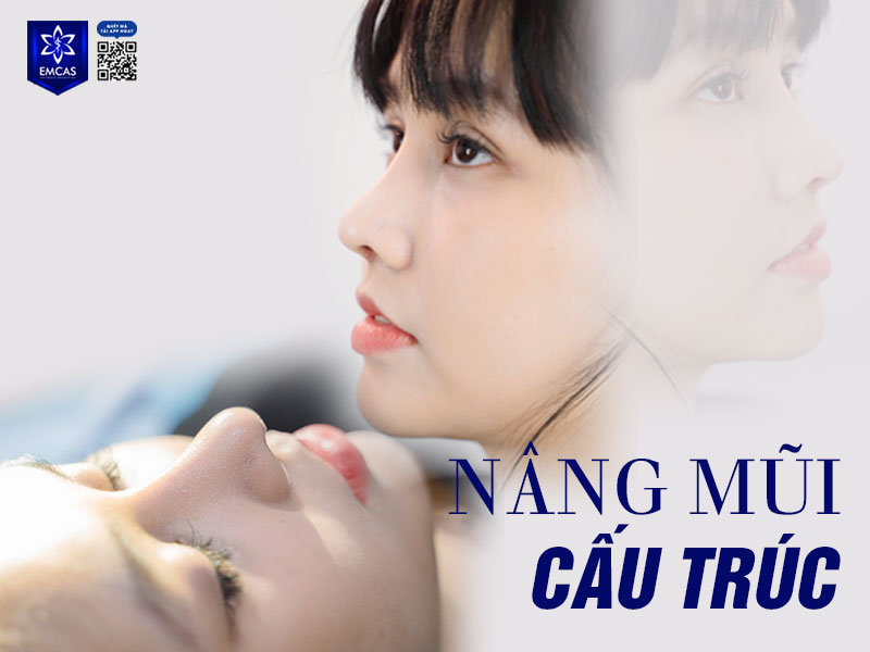 Nâng mũi cấu trúc là phương pháp thẩm mỹ can thiệp toàn bộ cấu trúc mũi, bao gồm sống mũi, đầu mũi và trụ mũi, giúp chỉnh sửa dáng mũi toàn diện.
