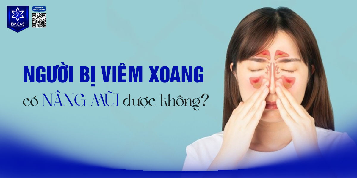NGƯỜI BỊ VIÊM XOANG CÓ NÂNG MŨI ĐƯỢC KHÔNG?