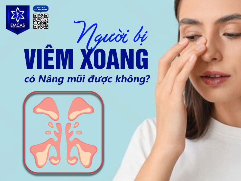 Người bị viêm xoang có nên nâng mũi không? Câu trả lời là có thể nâng mũi, vì quá trình nâng mũi chỉ can thiệp ở phần da và trên vùng xương mũi, không ảnh hưởng đến các xoang mũi bên trong.