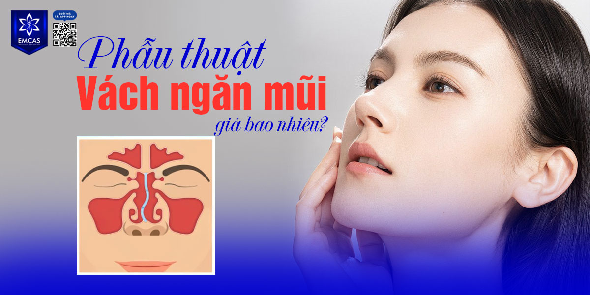 PHẪU THUẬT VÁCH NGĂN MŨI GIÁ BAO NHIÊU?