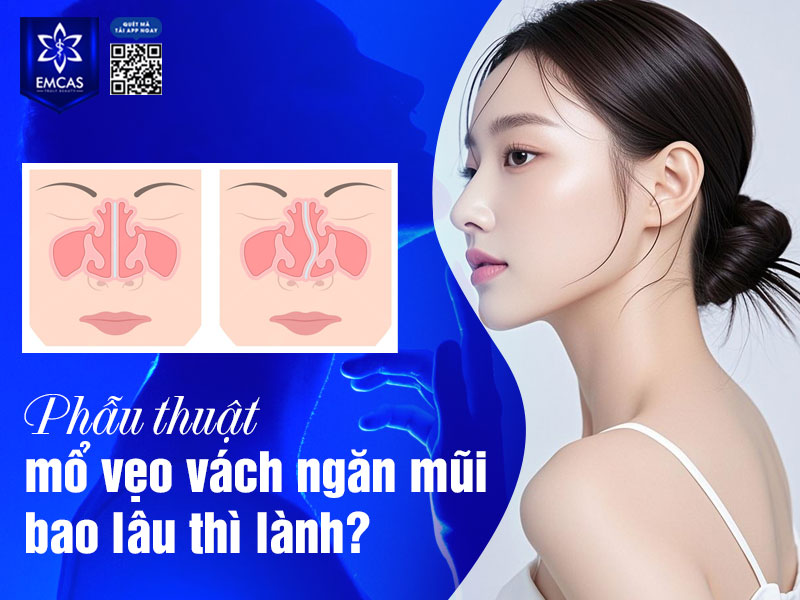 Thời gian hồi phục sau phẫu thuật lệch vách ngăn mũi phụ thuộc vào nhiều yếu tố như cơ địa của từng người, kỹ thuật mổ áp dụng, mức độ can thiệp và cách chăm sóc hậu phẫu.